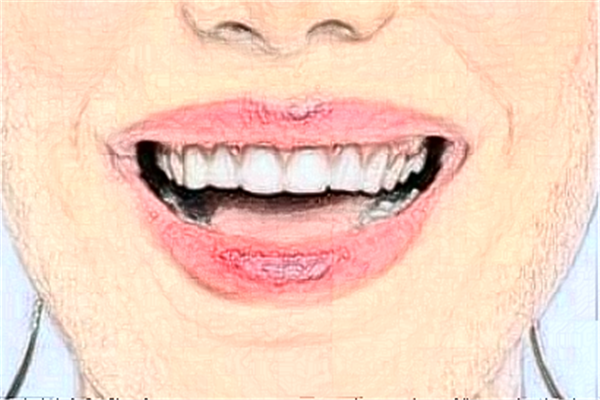 福州登特口腔醫(yī)院補(bǔ)牙好的大夫?醫(yī)生簡介