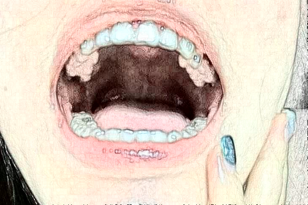 北京開顏口腔診所半口種植醫(yī)生整理!實(shí)力強(qiáng)人氣高!
