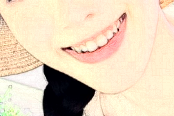 淮安諾貝爾口腔醫(yī)院隱形矯正怎么樣，附醫(yī)生信息一覽~