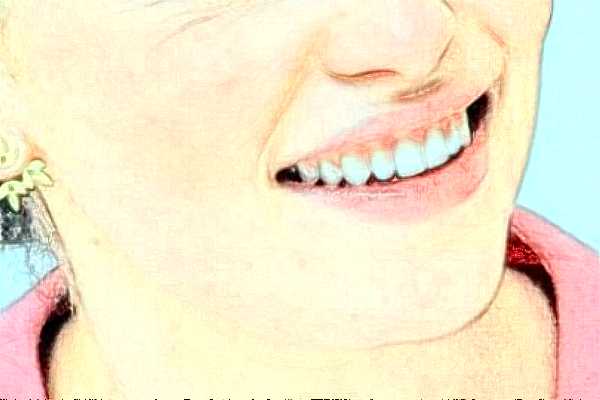 淮安諾貝爾口腔醫(yī)院隱形矯正怎么樣，附醫(yī)生信息一覽~