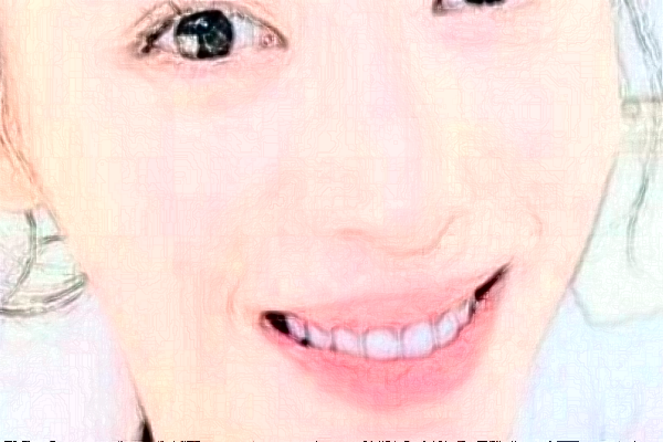 2024太原眾牙口腔醫(yī)院烤瓷牙價(jià)格多少?整形日記全過程分享