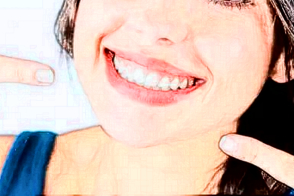 深圳樂莎莎口腔醫(yī)院怎么樣?洗牙做的怎么樣