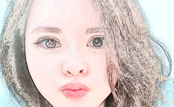 上海瑰麗醫(yī)療美容門(mén)診部打玻尿酸術(shù)后三個(gè)月求美案例|技術(shù)亮點(diǎn)怎么樣?需要多少錢(qián)