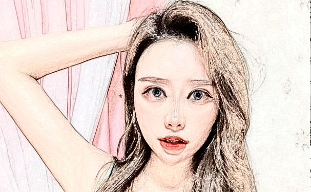 成都恒博天姿醫(yī)療美容門診部玻尿酸填充全臉90天案例欣賞|技術(shù)測評怎么樣?費(fèi)用多少