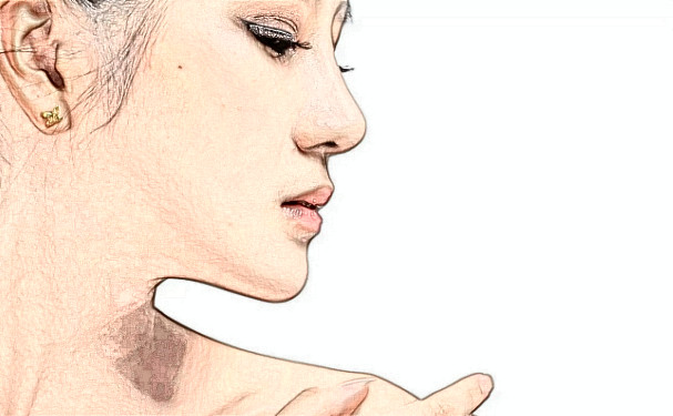 濟南韓氏外科整形醫(yī)院玻尿酸填充技術(shù)等級怎么樣?術(shù)后案例&價格一覽表