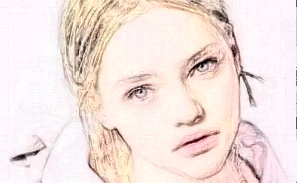 北京藝美碩德醫(yī)療美容診所射頻除皺技術(shù)級別怎么樣?術(shù)后三個月案例反饋