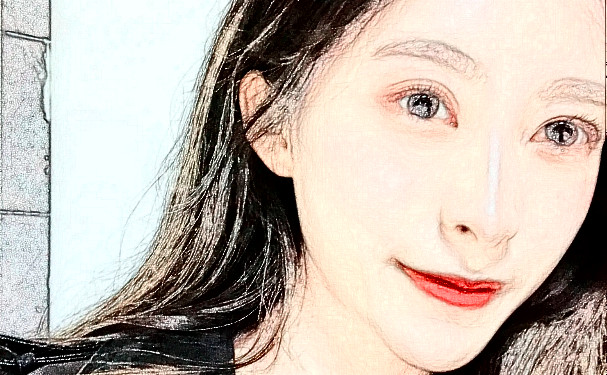 濟南愛容整形美容醫(yī)院玻尿酸填充下巴技術等級怎么樣?術后案例&一般多少錢