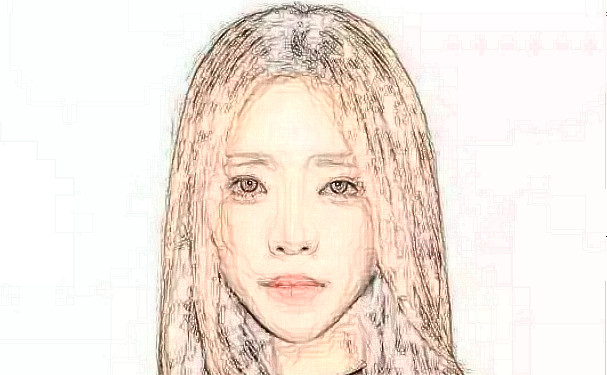 沈陽和平藍天醫(yī)療美容門診部玻尿酸填充全臉費用多少?技術(shù)亮點&術(shù)后半年求美案例