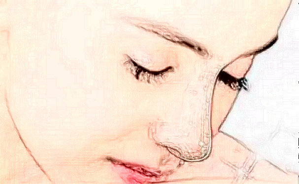 杭州古浚醫(yī)整形醫(yī)院隆鼻術后半年求美案例(效果怎么樣?技術優(yōu)勢)