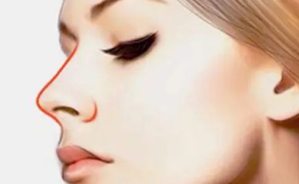 西寧華美整形醫(yī)院鼻整形多少錢?技術(shù)級別&120天案例點評