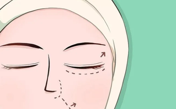 檸悅美容整形做腫泡眼雙眼皮技術(shù)怎么樣?費(fèi)用查詢?術(shù)后半年案例點(diǎn)評