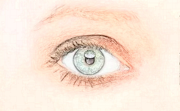 濟南瑞麗醫(yī)療美容醫(yī)院割雙眼皮技術怎么樣?120天案例曝光