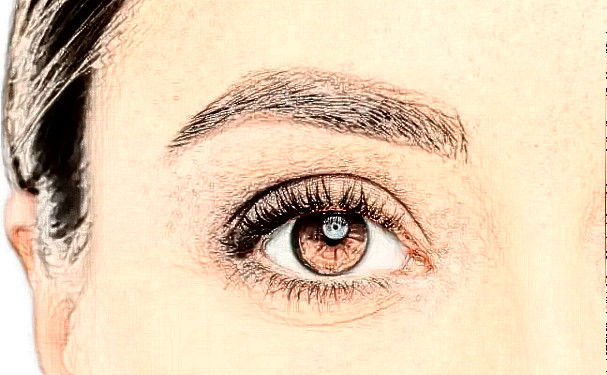 成都美上美醫(yī)療美容門診部做雙眼皮術(shù)后三個(gè)月求美案例&收費(fèi)標(biāo)準(zhǔn)?