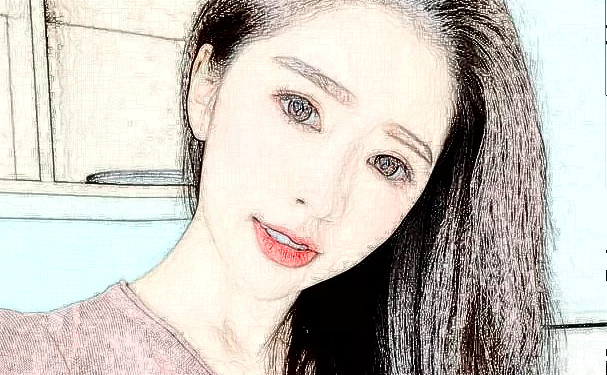 紹興華美整形醫(yī)院三點雙眼皮技術(shù)怎么樣?費用標準?術(shù)后一年案例曝光