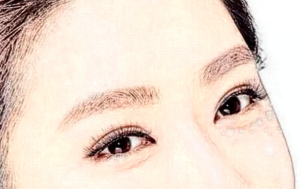 常州102醫(yī)院全切雙眼皮價(jià)格表?技術(shù)優(yōu)點(diǎn)怎么樣?