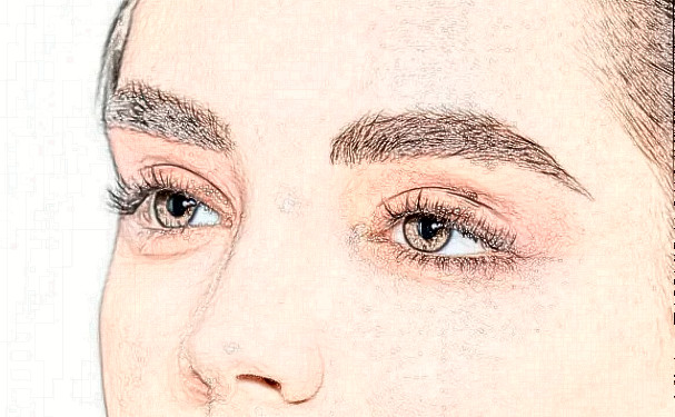 廊坊華康醫(yī)療美容門診部割雙眼皮術(shù)后一年案例欣賞&價格查詢?