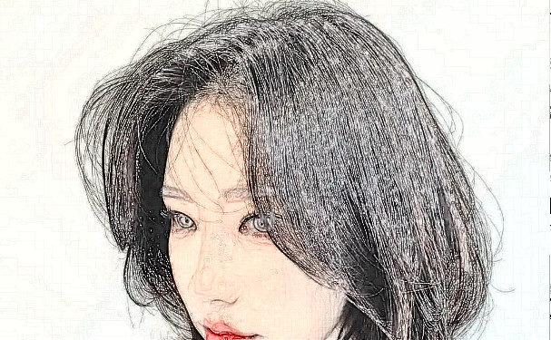 叢生植發(fā)植發(fā)一年案例點(diǎn)評(效果怎么樣?技術(shù)亮點(diǎn))