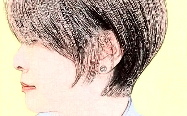 上海葦渡醫(yī)療 PherriMed植發(fā)技術怎么樣?多少錢?心動案例