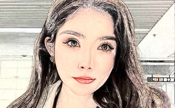 安慶石化醫(yī)院整形美容中心疤痕植發(fā)90天求美案例&價目表?