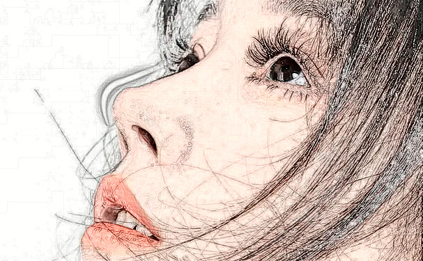 天津津門中醫(yī)院毛發(fā)移植120天經(jīng)典案例&技術(shù)怎么樣?