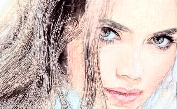 成都武侯艾米麗醫(yī)療美容門診部植發(fā)技術怎么樣?術后半年經典案例