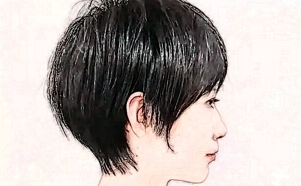 成都美萊醫(yī)學(xué)美容醫(yī)院植發(fā)術(shù)后半年經(jīng)典案例&價(jià)格明細(xì)?