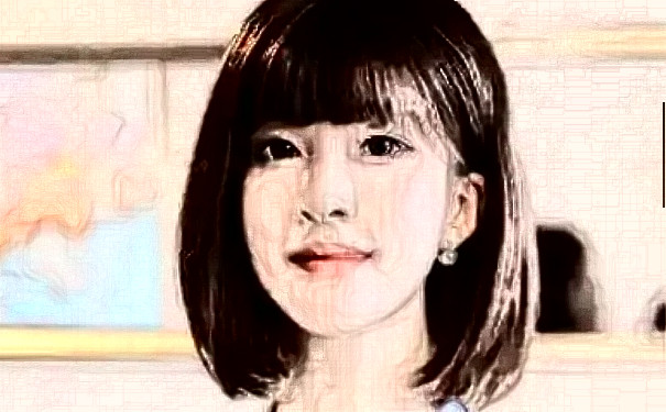 青島熙朵醫(yī)療美容診所植發(fā)術(shù)后三個月案例曝光&技術(shù)怎么樣?