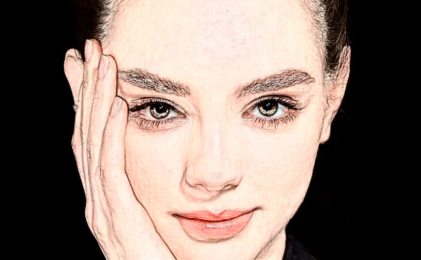 Loveme樂美整形臉部脂肪填充技術(shù)怎么樣?術(shù)后半年案例點(diǎn)評|費(fèi)用多少