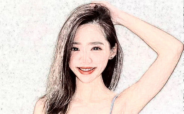 天津河西坤如瑪麗婦產(chǎn)醫(yī)院種植頭發(fā)術后一年經(jīng)典案例&技術怎么樣?