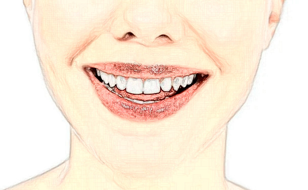 岳陽(yáng)市岳化醫(yī)院姚予濱牙齒歪斜矯正技術(shù)怎么樣?價(jià)目表?案例變化