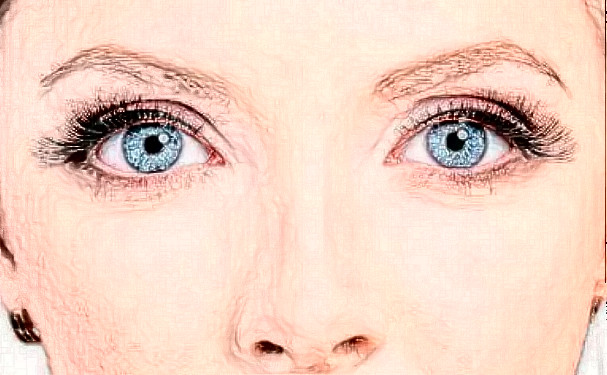 鄭州人民醫(yī)院付斌玻尿酸豐淚溝收費(fèi)多少?術(shù)后120天案例,醫(yī)院介紹