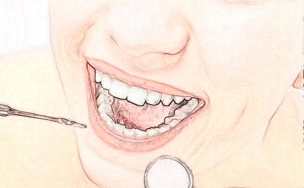 北京天壇醫(yī)院白保晶種植牙技術(shù)優(yōu)勢(shì)怎么樣?經(jīng)驗(yàn)案例