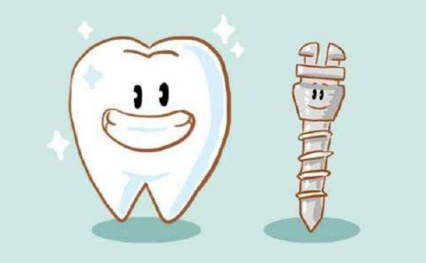 北京天壇醫(yī)院白保晶種植牙技術(shù)優(yōu)勢(shì)怎么樣?經(jīng)驗(yàn)案例