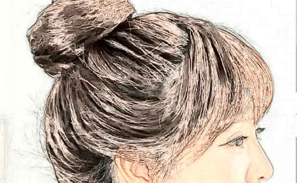 上海九院劉清種植頭發(fā)費用標(biāo)準(zhǔn)?恢復(fù)案例,醫(yī)生介紹