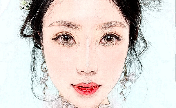 河北省兒童醫(yī)院張文顯微整形瘦臉術(shù)后案例&價(jià)格查詢?