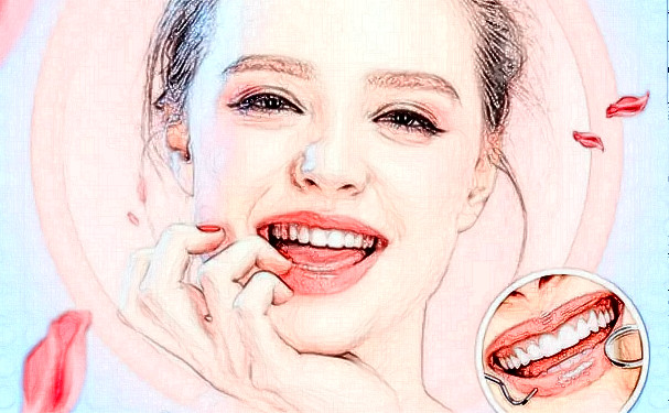 廣州醫(yī)科大學(xué)附屬口腔醫(yī)院施健巍牙齒正畸實(shí)力案例&價(jià)格查詢?