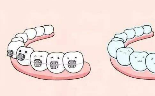 廣元市中心醫(yī)院牙齒歪斜矯正醫(yī)生排名,技術(shù)評(píng)測(cè)&醫(yī)院優(yōu)勢(shì)