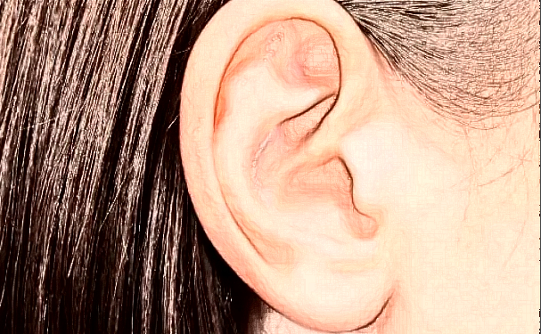 中國人民解放軍聯(lián)勤保障部隊第九〇〇醫(yī)院招風耳整形技術怎么樣?醫(yī)院信息