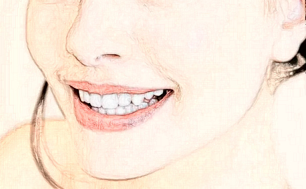 北京大學(xué)口腔醫(yī)院第二門診部桑艷輝牙齒整形收費(fèi)多少?術(shù)后案例,醫(yī)院實(shí)力分析