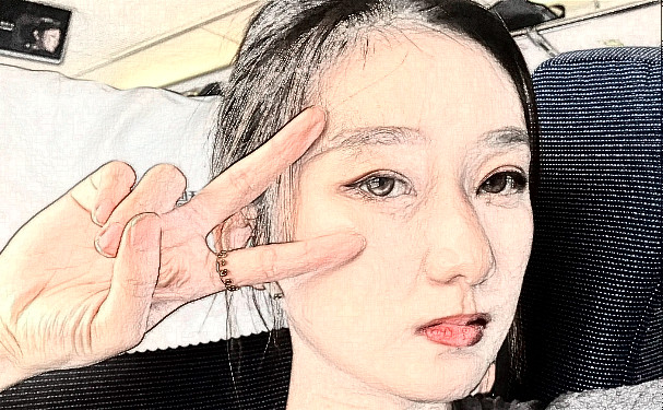 西南醫(yī)科大學(xué)附屬醫(yī)院疤痕修復(fù)手術(shù)技術(shù)怎么樣?報價多少?求美案例